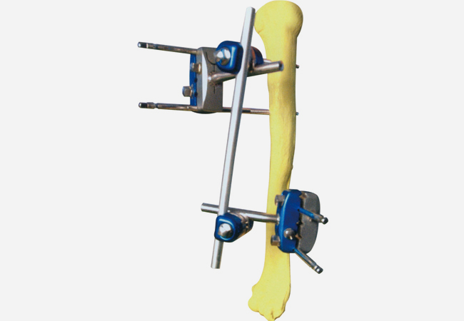  Ⅳ型2號 肱骨支架